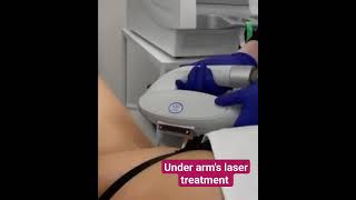 Laser treatment for underarmsskincare glowingskin hair laser likeandsubscribe