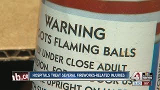 Numerous injuries from fireworks over weekend