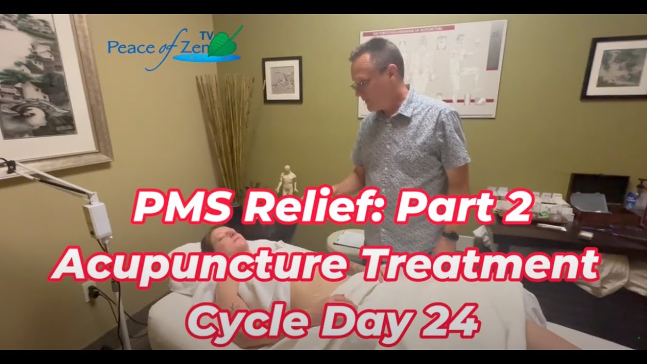 (Part 2) Acupuncture Treatment for PMS | Supporting Emotional Balance, Energy & Cramp Prevention