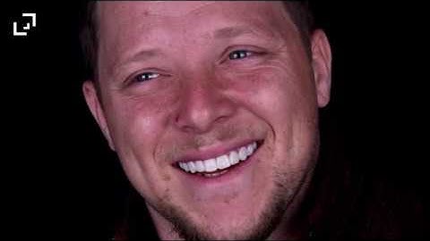 Emotional Dentistry with the Digital Smile Design