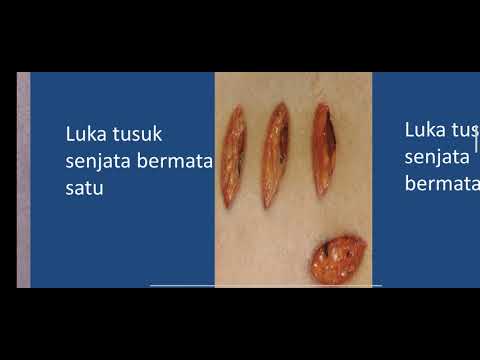 Kuliah Forensik : Traumatologi / ilmu tentang luka