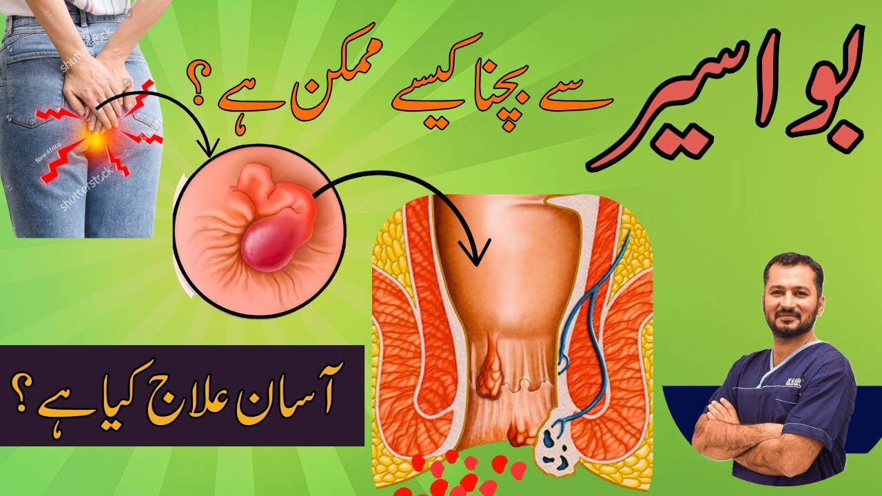 How to PREVENT HEMORRHOIDS, Constipation Relief SECRETS Revealed