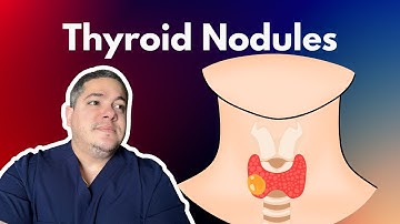 Thyroid Nodules