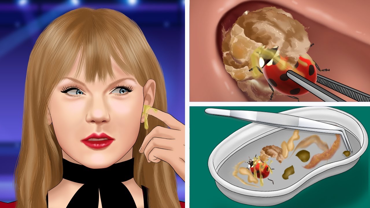 ASMR Clean the ear canal to remove insects and excess earwax | Earwax removal animation