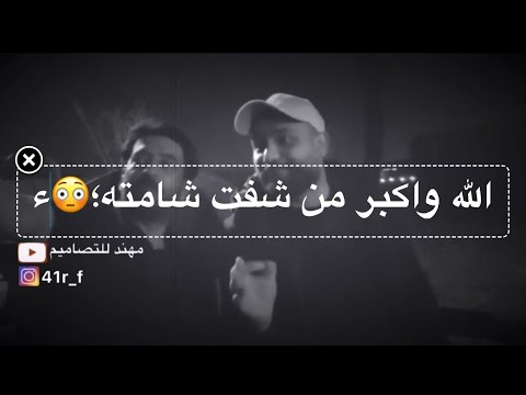 الله واكبر من شفت شامته علي الشيخ جاي يتغزل بحبيبته ام شامه مو شعر غزل يجنن وربي حالات واتساب