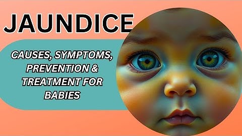 Jaundice in Newborns Explained | Causes, Symptoms, Prevention & Treatment for Babies