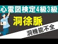 洞徐脈【チャレンジ心電図検定4級3級】