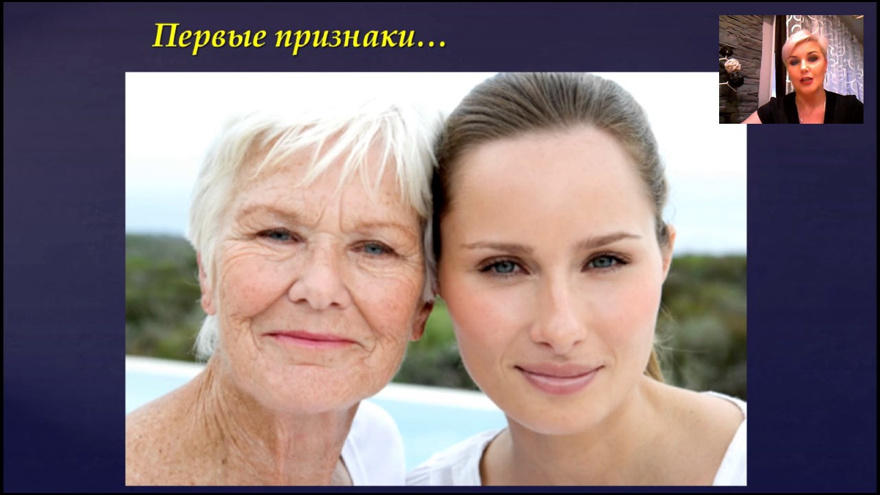 Гутчисон гилфорд прогериа. Тиффани ведекинд прогерия. Преждевременное старение форум. Еврейки рано стареют. Прогерия хатчинсона-гилфорда.