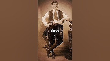 5 People With Extra Limbs You