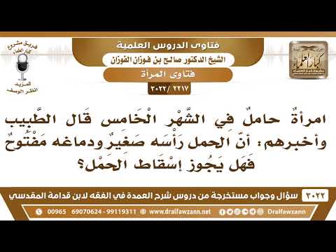 [2217 -3022] إذا قرر الطبيب أن الحمل لن يعيش، فهل يجوز إسقاطه حينئذ؟