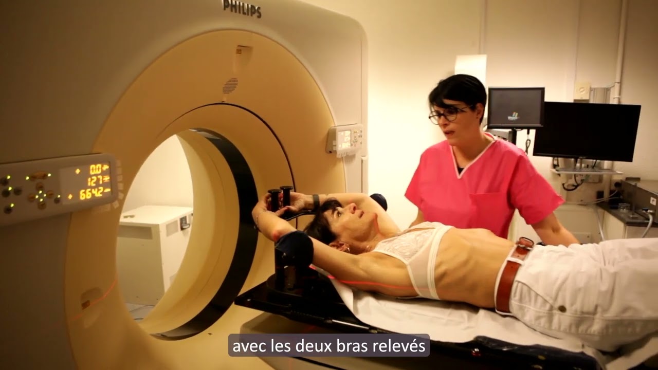 Prise en charge du cancer du sein - LA RADIOTHERAPIE