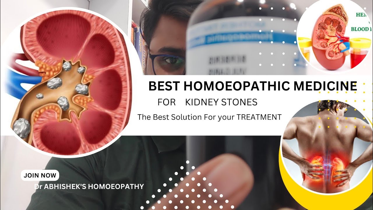 Homeopathic medicine for kidney stoneगुर्दे की पथरीkidney pain