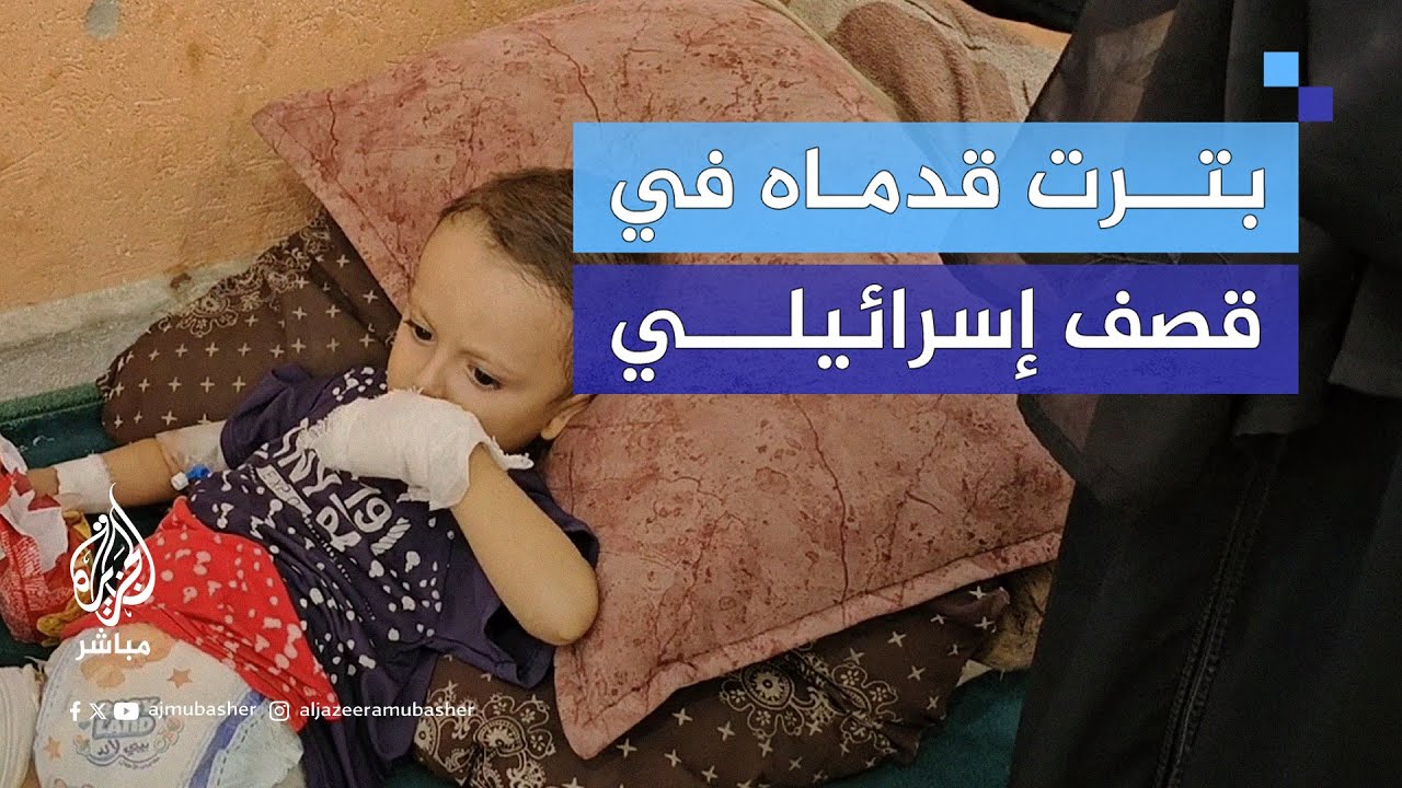 بُـتـ.ـرت قدماه.. مأساة "جهاد يوسف" شاهدة على انتهاكات الاحتـلال بحق أطفال غزة
