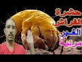حشرة الفراش حشرات الفراش الغير مرئية والتي تسبب الحساسية والتهاب العين واحتقان الزور