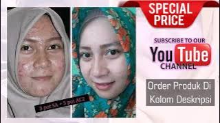 drw skincare asli dan palsu