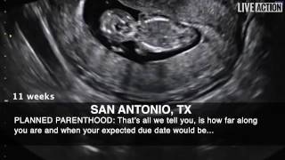 Ultrasounds for Killing, Not Care, at Planned Parenthood