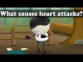 What causes heart attacks  aumsum kids science education children