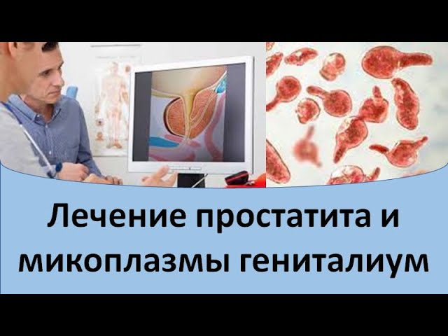микоплазма гениталиум у женщин что это такое микоплазма гениталиум у женщин что это такое
