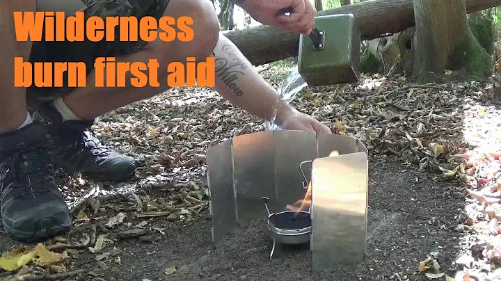 Wilderness burn first aid