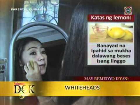 Natural remedy for whiteheads
