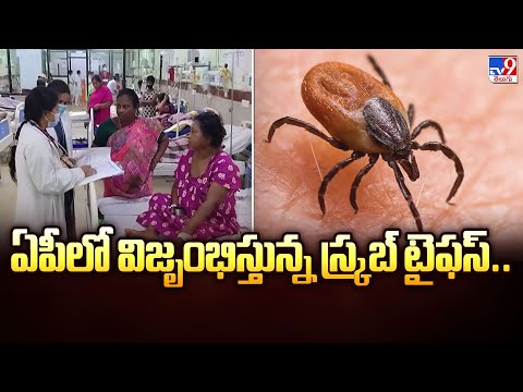 Scrub Typhus: : ఏపీలో విజృంభిస్తున్న స్క్రబ్ టైఫస్.. - TV9 - TV9