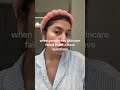 I have many? #acne #skin #skincare