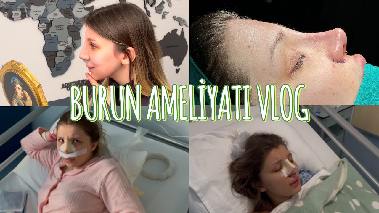 Burun Ameliyatı Oldum!!! Hastane anları , Anestezi etkisi , Komik anlar
