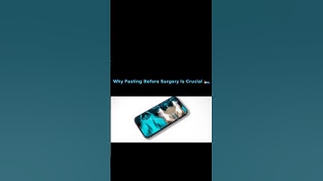 Why Fasting Before Surgery Is Crucial 🛌#shorts #trending #viralshorts