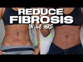 HOW TO: Compress and wear foams properly | At home massages | Reduce Fibrosis + Swelling after Lipo