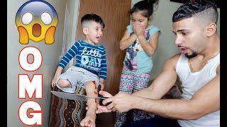 CUTTING LEG OFF PRANK GONE WRONG!!