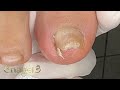 😱 Espícula pontiaguda #satisfying #nails