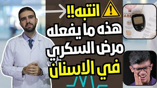 انتبه ! هذه ما يفعله مرض السكري في الاسنان | تأثير السكري على الاسنان