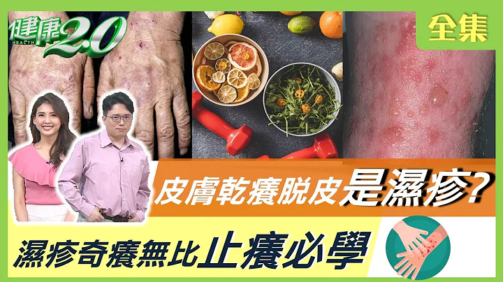 皮肤干痒脱皮竟是湿疹？湿疹奇痒无比止痒必学 健康2.0 20210417 (完整版) - 天天要闻