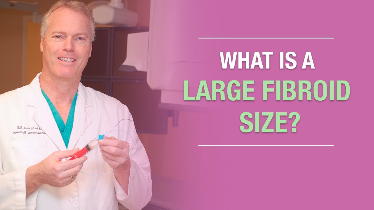 What Is A Large Fibroid Size YouTube