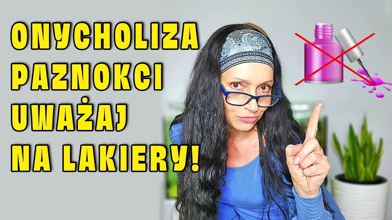 Grozi Ci Onycholiza Paznokci Jeśli Stosujesz Lakiery i Odżywki z Formaldehydem!