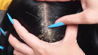 ASMR Pure Tingles ✨ Slow Scalp Care & Soft Hair Sounds for Deep Sleep 00404 screenshot 1
