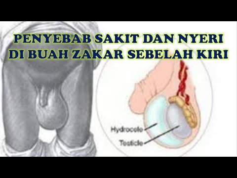 PENYEBAB SAKIT DAN NYERI DI BUAH ZAKAR SEBELAH KIRI - YouTube