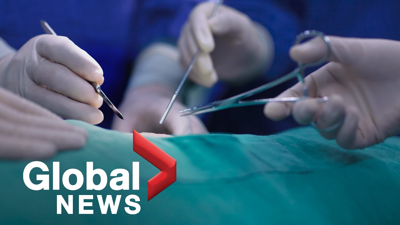 COVID-19 pandemic delayed 560,000 surgeries in Canada according to study