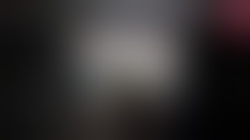 Kinh ngạc bệnh nhân chơi vĩ cầm lúc bác sĩ phẫu thuật cắt bỏ u não | VTV24