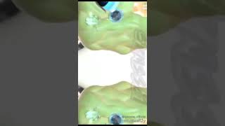 The Best Lps Musically