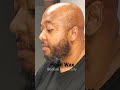 #HeadWax Follow Up #ScalpWax #BaldHead #BarberShop Nope 🤣