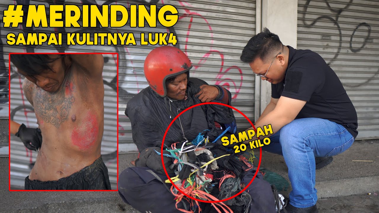 Mengejutkan pas kita buka lilitan sampah di badannya nya, kok bisa seperti ini !!
