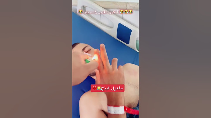 من اثار البنج 🤣🤣🤣🤣