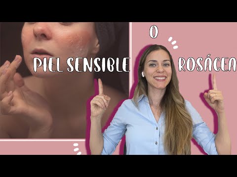Tengo Rosácea o