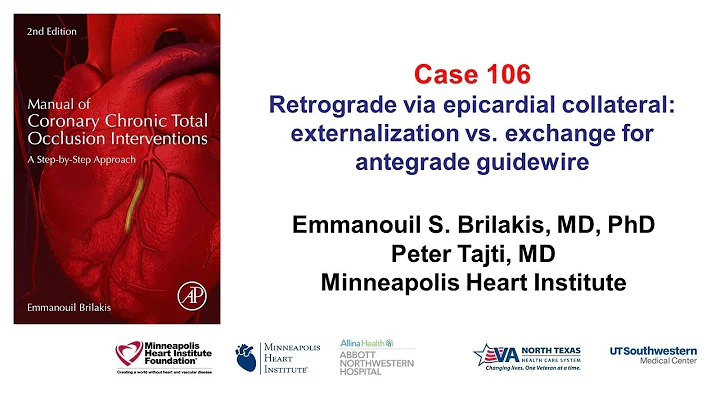 Case 106: Manual of CTO interventions: Retrograde via epicardial collateral