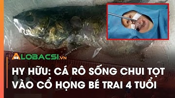 Hy hữu: Cá rô sống chui tọt vào cổ họng bé trai 4 tuổi | Video AloBacsi