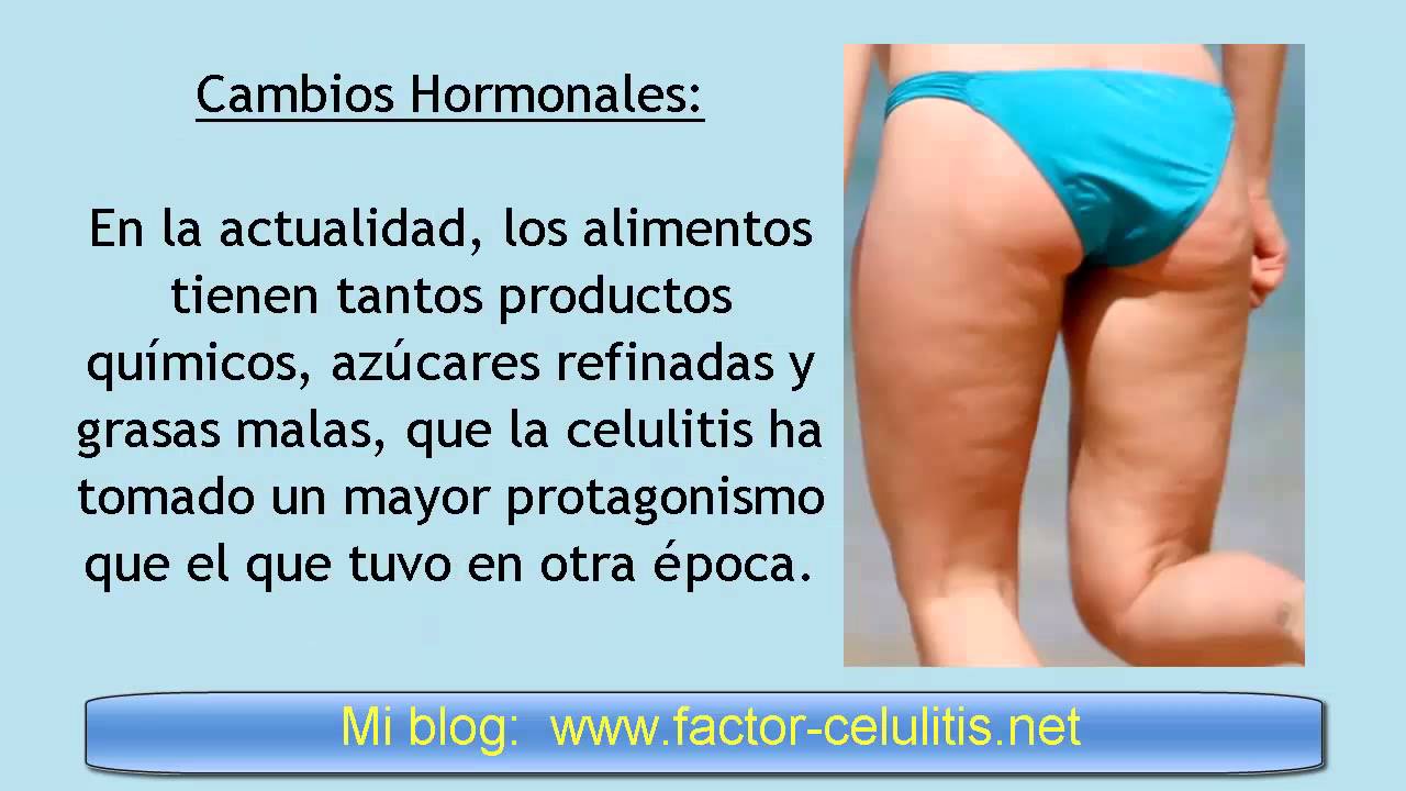 Como eliminar las estrias rapidamente