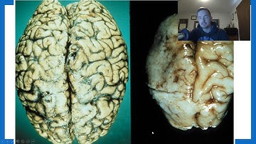 PSYC 101: Chapter 9 -- Introduction to Human Development