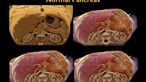 Advanced Volume Rendering for Lifelike Image Presentation