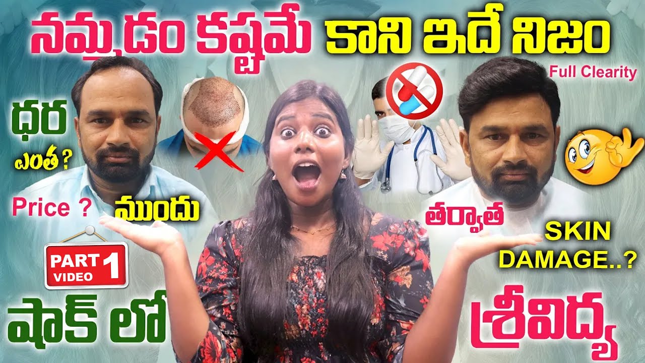 నమ్మడం కష్టమే కాని ఇదే నిజం / Price ? / Low Cost & Best Hair Patch In Non Surgical Hair Replacement